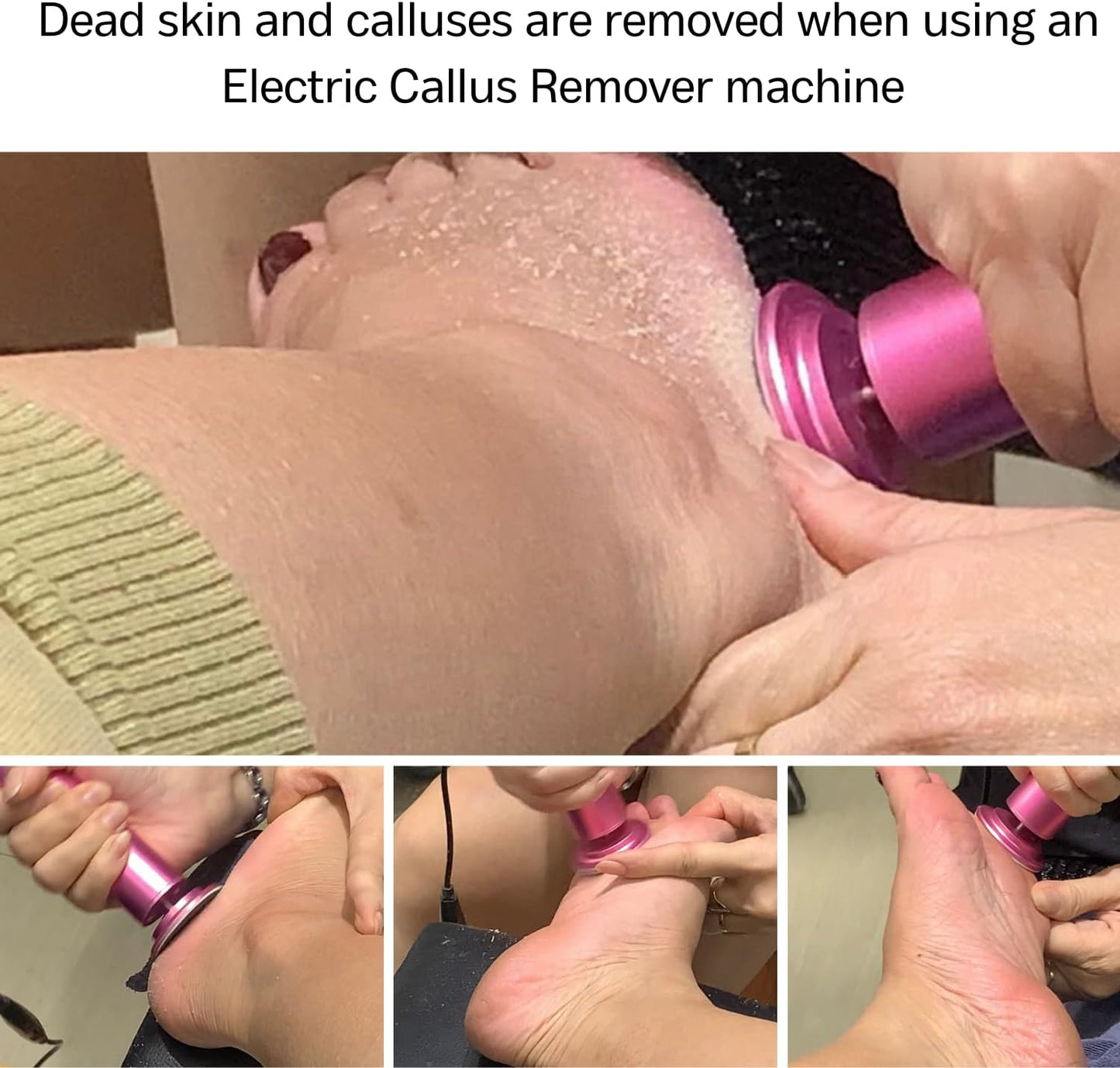 💥 Free Shipping💥 48% Off-Electric Foot  callus Remover